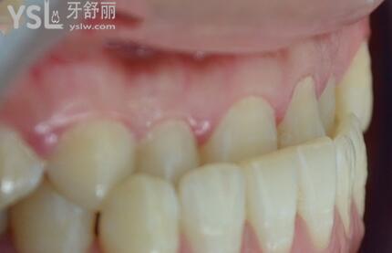 70dce99197cb4ae48d05125ffb62ec37_th.jpg