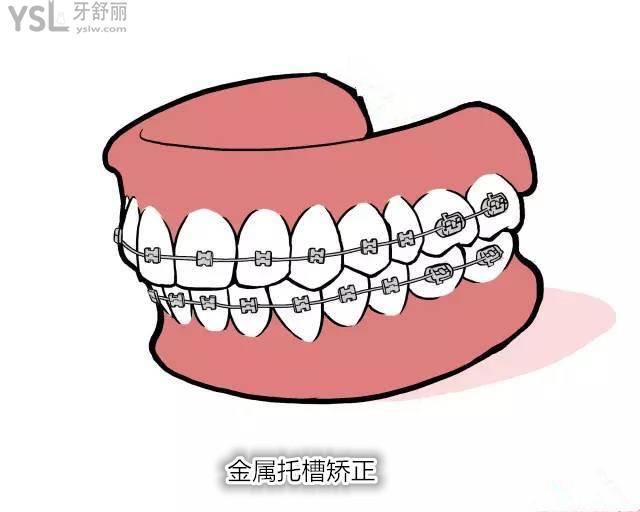 v2-ccb37d45952580e0da72da293f5cafc3_b.jpg