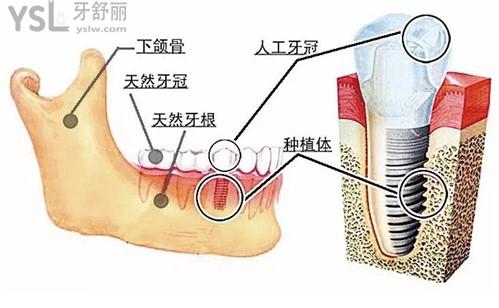 33aa0c65d60e4d1fa473a1e53deb0043.jpg