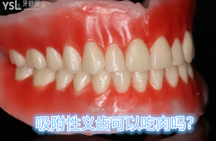 76448AC4-0896-42a9-AAE7-CFF7426A3F1B.png
