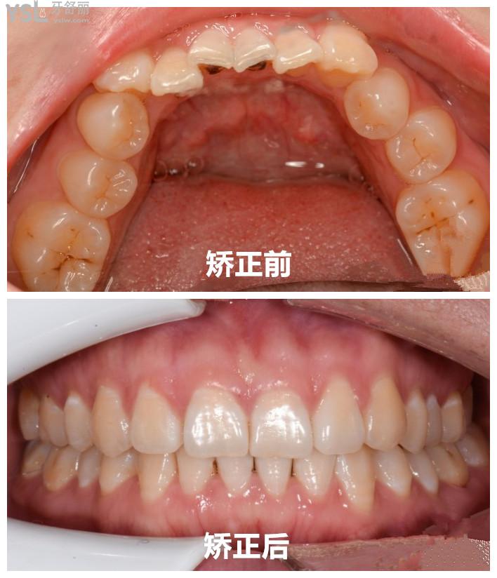 {F91EA54D-4CF9-4FE6-A091-8AD869872A9D}_20200417154335_副本.jpg