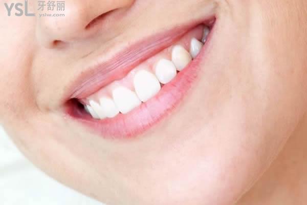 拔牙禁忌你知道多少？