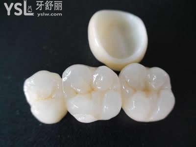 氧化鋯烤瓷牙的優(yōu)缺點？