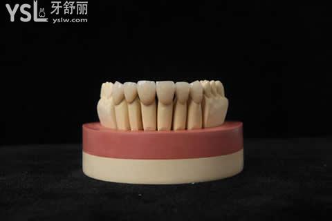 假牙的種類有哪些：