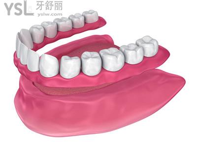 全口義齒的排牙檢查？