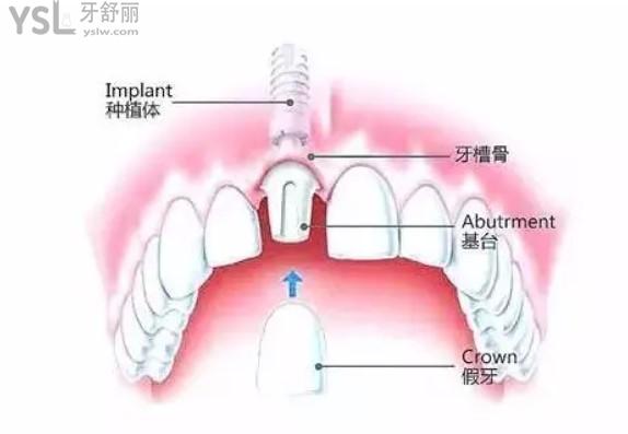 {F6EF536D-05BE-4533-B7FA-CF74D2845F02}_20200526170917.jpg