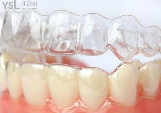 牙齒正畸