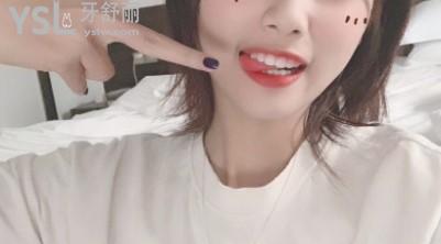 牙齒矯正圖