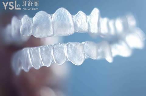 隱適美隱形矯正有年齡限制嗎？
