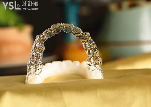 隱適美矯正治療的五步