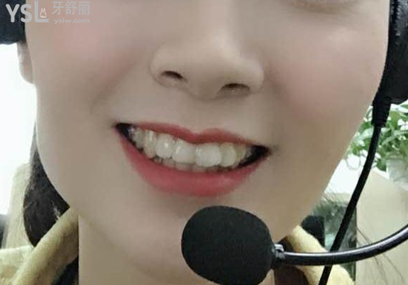 帶牙套后悔一輩子，我覺得不帶牙套才會后悔