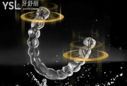隱適美和時代天使隱形矯正如何選擇？