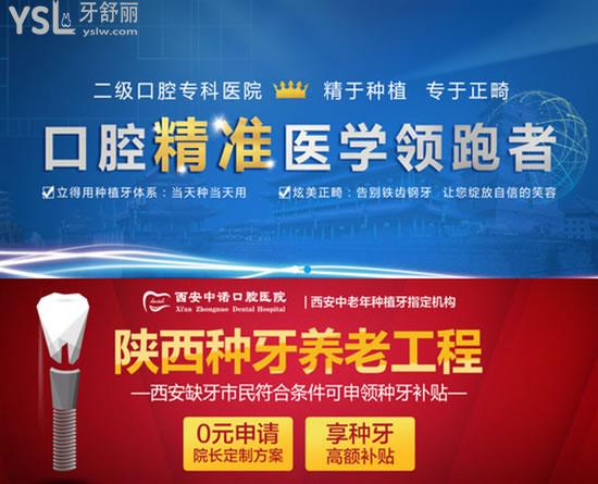 西安中諾口腔醫(yī)院口碑項(xiàng)目