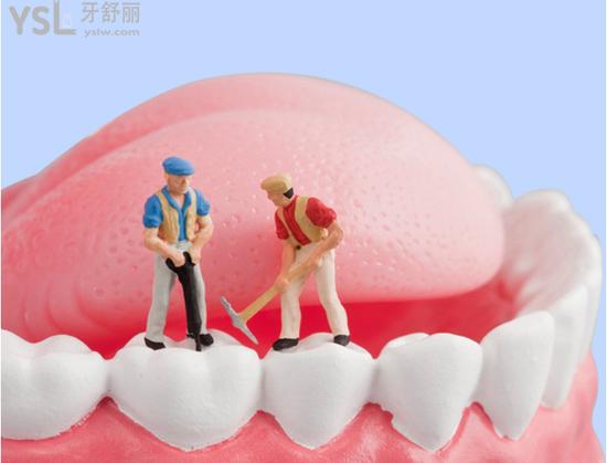 廈門峰煜口腔特色種植牙技術