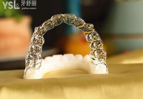 佩戴正雅隱形矯正期間的復(fù)診問題？