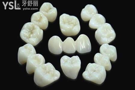 全瓷牙和烤瓷牙的區(qū)別有哪些？