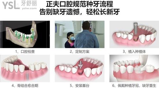 深圳正夫口腔種植牙