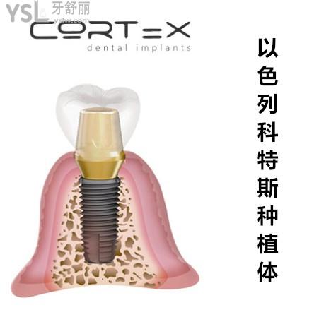 以色列科特斯（cortex種植體）