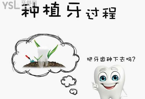 種植牙應(yīng)該如何選擇種植體？