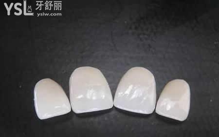 3D超薄瓷貼面的優(yōu)勢(shì)：