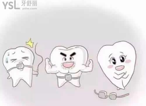 進(jìn)口3M陶瓷半隱形矯正價(jià)格