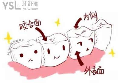 牙齒美白的方式有哪些？