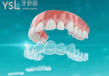 時代天使COMFOS：