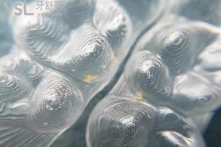 COMFOS和時代天使隱形矯正有啥區(qū)別？