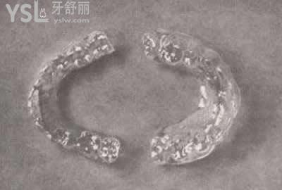 正雅隱形矯正的費(fèi)用：