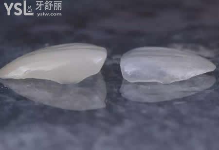 做全瓷貼面有哪些要注意的？