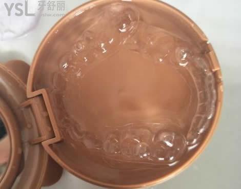 隱形牙套和傳統(tǒng)牙套的區(qū)別：