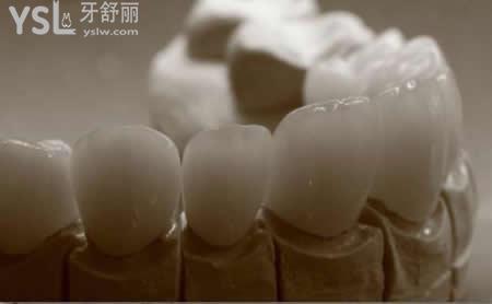 不同價(jià)位的全瓷牙有什么區(qū)別：