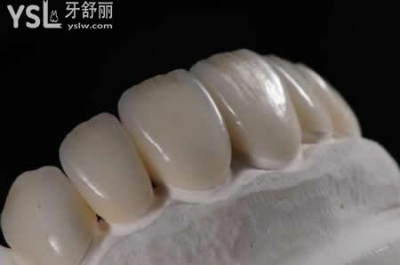 全瓷牙的優(yōu)點(diǎn)？