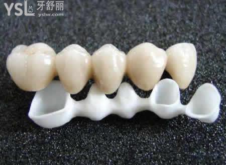 二氧化鋯全瓷冠特點(diǎn)： 
