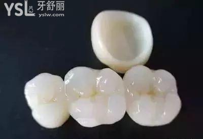 二氧化鋯全瓷冠是否**：