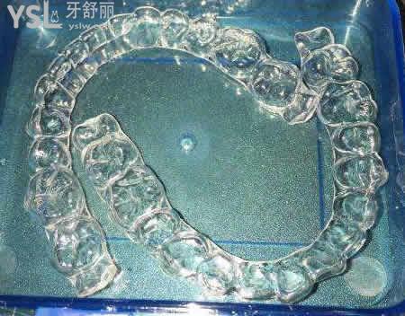 時(shí)代天使隱形矯正的優(yōu)勢(shì)：