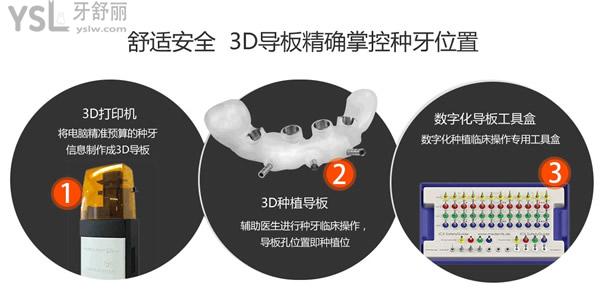 長沙美奧口腔種植牙