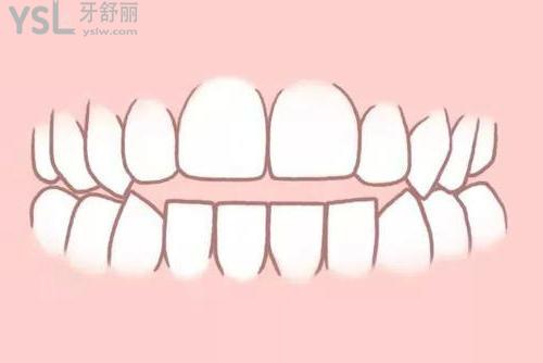 u=177646213,2568340227&fm=26&gp=0.jpg