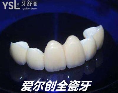 愛(ài)爾創(chuàng)全瓷牙