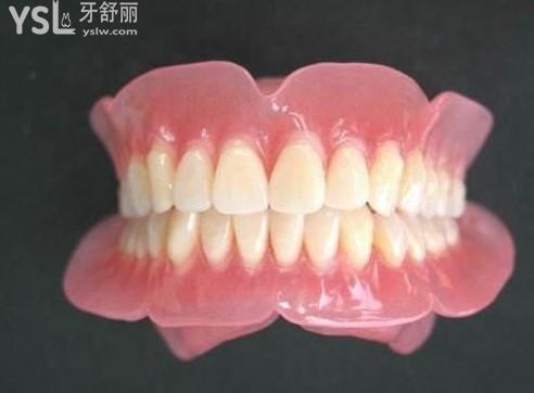 吸附式全口義齒