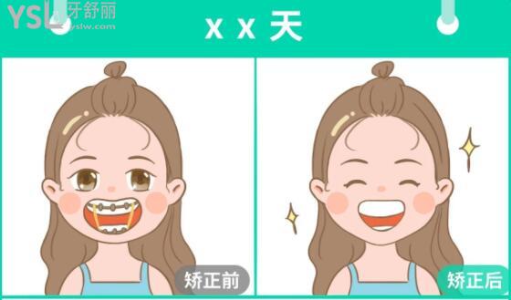 金屬牙套價(jià)目表