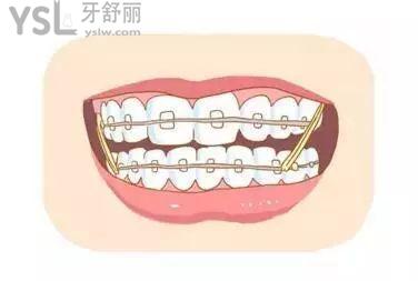 u=3175270746,3898351762&fm=26&gp=0.jpg