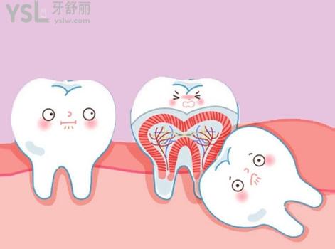 拔智齒后悔死了是真的嗎，拔智齒會很疼嗎？