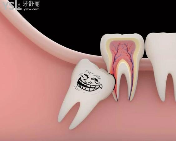 拔智齒后悔死了是真的嗎，拔智齒會很疼嗎？