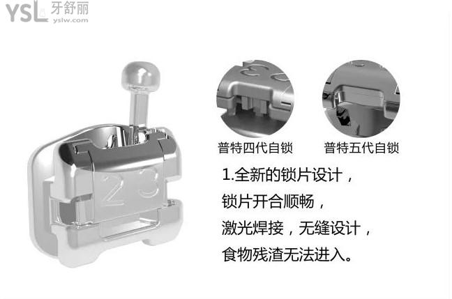 普特五代自鎖托槽特色