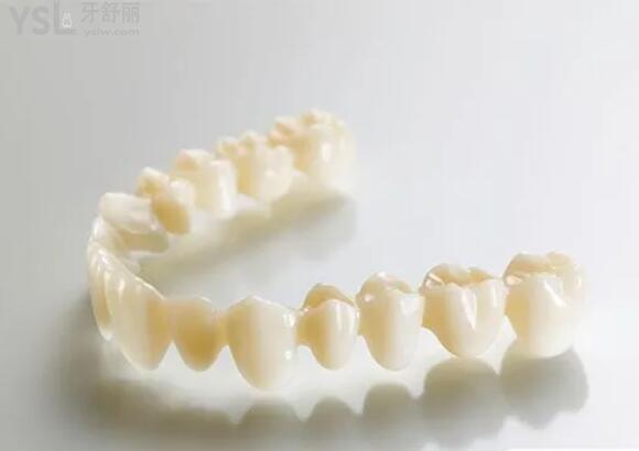 全瓷牙哪個品牌質量好