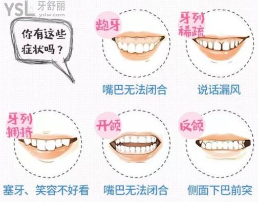 這些癥狀都需要做牙齒矯正
