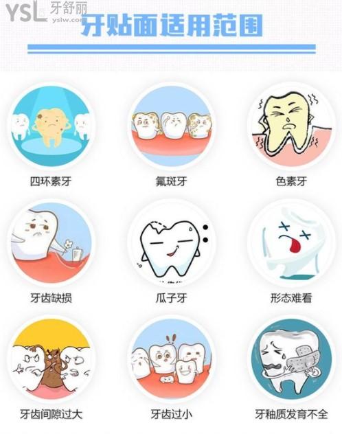 牙貼面的適用范圍