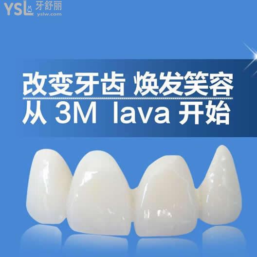 美國3m拉瓦全瓷牙