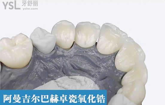 德國阿曼吉爾巴赫全瓷牙